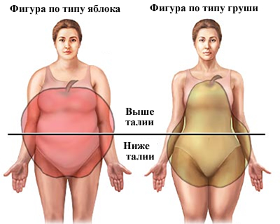 Ожирение