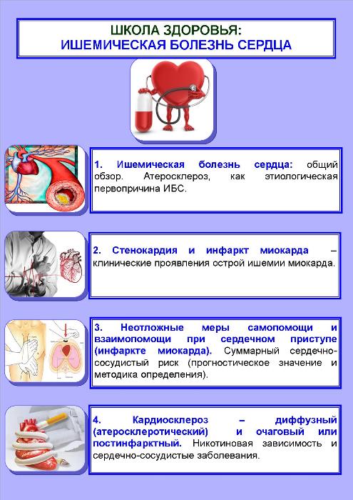  ИБС