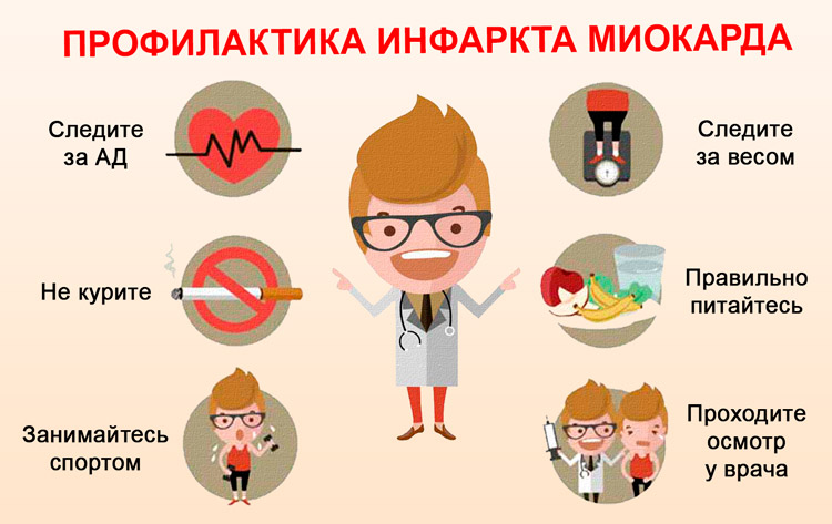 Инфаркт миокарда
