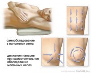 Профосмотр.Самостоятельное обследование молочных желез