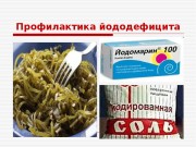 Профилактика йоддефицитных заболеваний